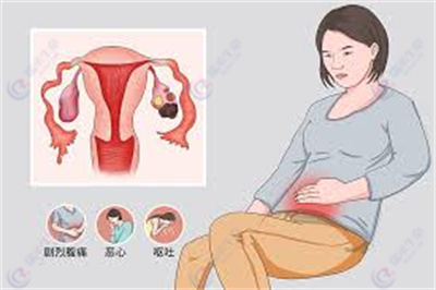 存在附件囊肿，做试管婴儿过程中应注意什么？