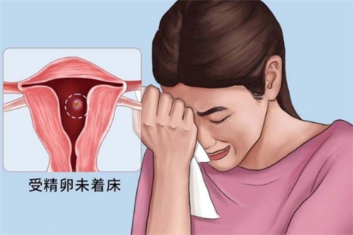 有宫颈息肉会影响试管婴儿周期吗？