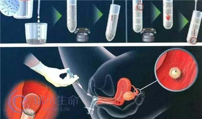 养囊是在浪费胚胎吗？试管婴儿科普！