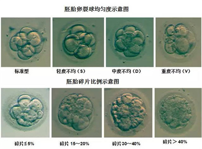 做试管婴儿如何从多方入手降低胚胎碎片率？