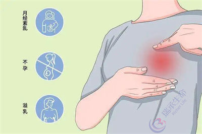高泌乳素血症更容易发生黄体功能不足吗？对做试管有什么影响