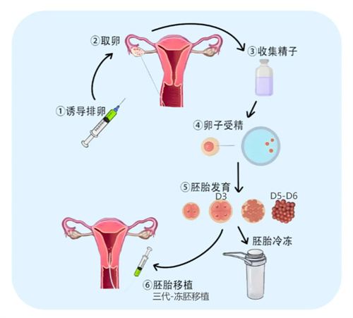 高泌乳素血症更容易发生黄体功能不足吗？对做试管有什么影响