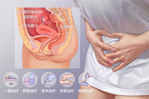 什么是盆腔炎，它是如何引发女性不孕症的？