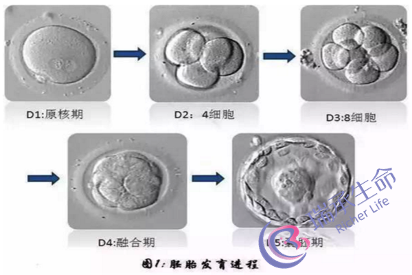 你知道子宫内粘连有什么症状吗？