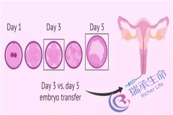 输卵管造影几年内有效？孕前还需要做检查么？