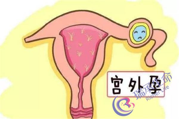 输卵管积水的症状是什么？还能正常怀孕么？