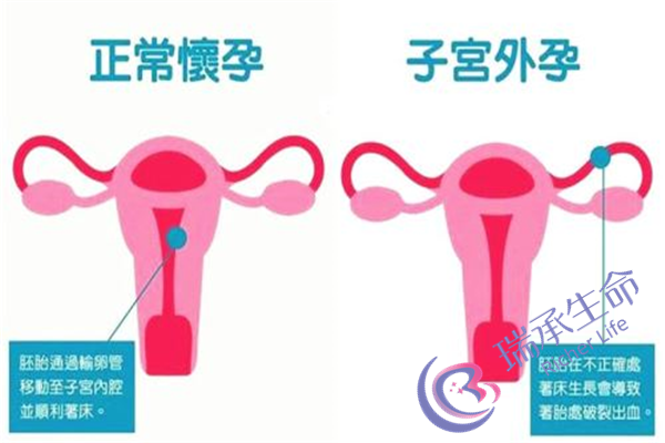 南京妇幼做试管婴儿要多少钱？为什么价格不同？