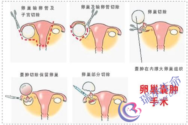 同房为什么不怀孕？有哪些原因造成？