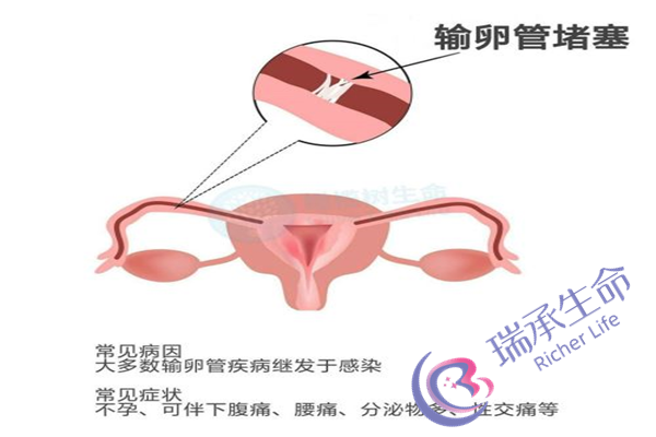 天津试管婴儿好不好？做试管婴儿要注意什么？