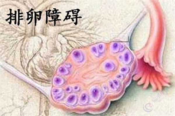 排卵异常一般与什么因素有关？试管婴儿科普详解