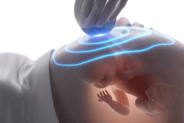 夫妻双方基因正常且做了第三代试管，孕期还要大排畸吗？