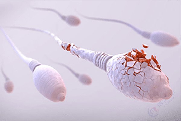 精子碎片率高，需要做第几代试管婴儿？
