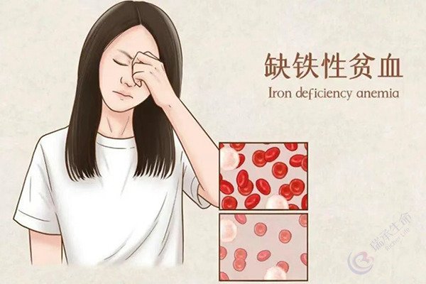 缺铁性贫血会对做试管婴儿造成影响吗？深度剖析与应对策略