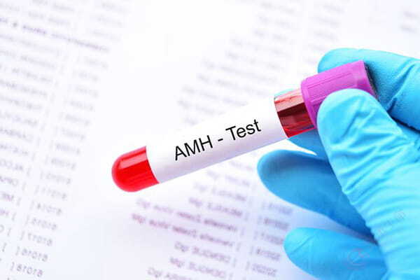 AMH越高越好吗？试管周期里查它，真正看的是这三件事