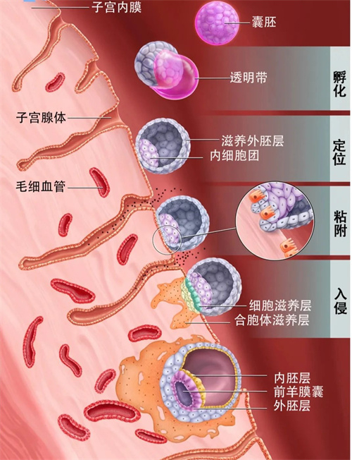试管婴儿移植后,囊胚着床有哪些征兆/感觉?