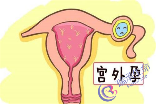 子宫内膜异位治疗费用是多少？治疗费用和哪些因素有关？